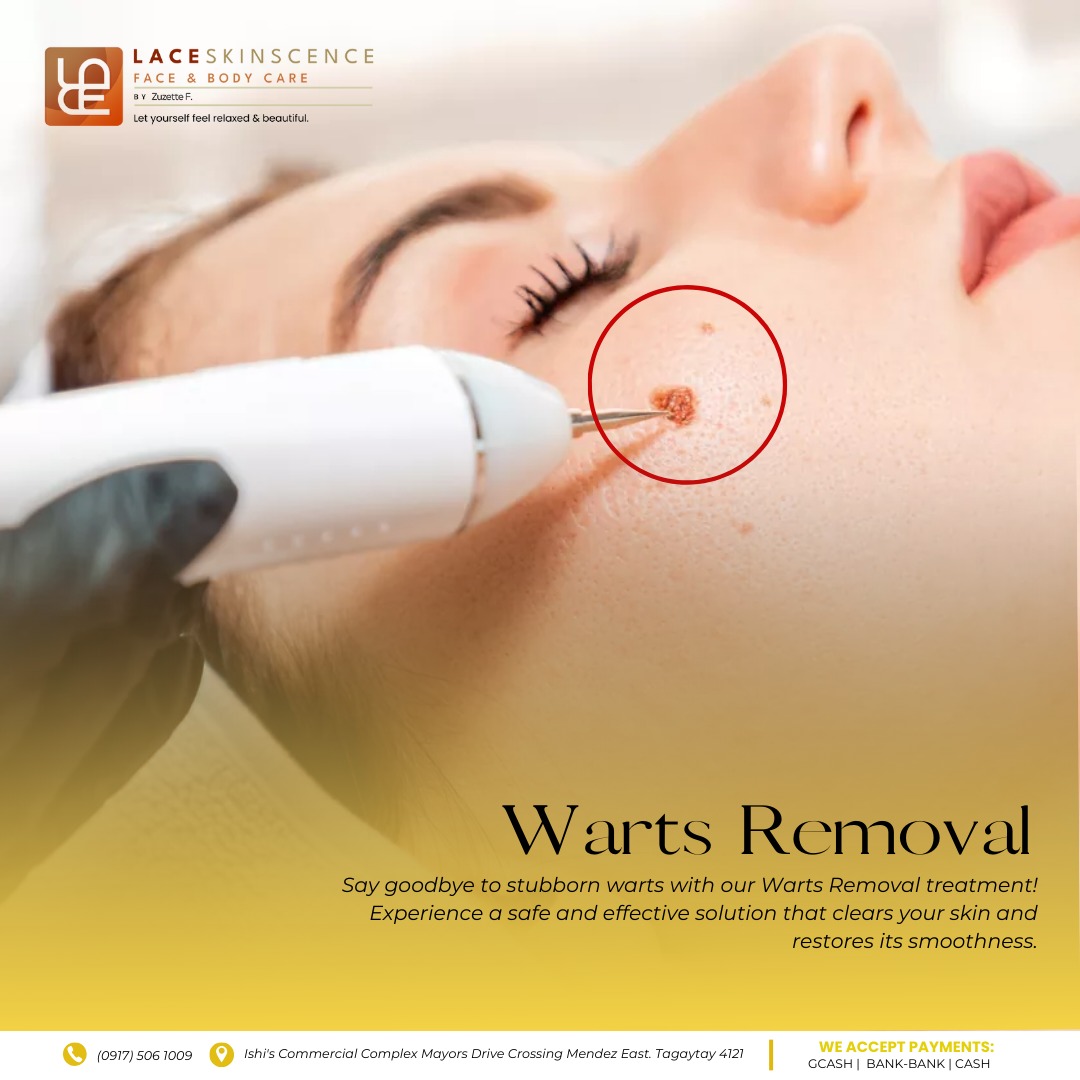 Warts Removal - Face Area